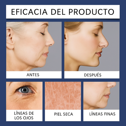 QINGLIN Antiarrugas Premium 50g – Importado de Corea + Mascarilla de Regalo (Stock Limitado)