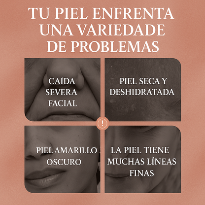 Botox Natural Sangre de Dragón – Pide 1 y Llévate 3 (Últimas Unidades)