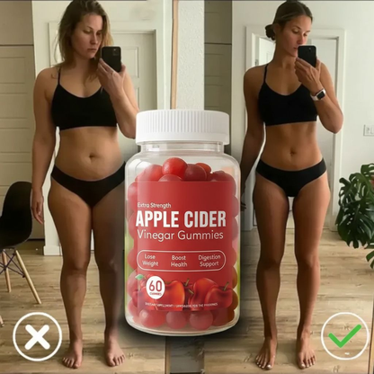 🍏 APPLE CIDER® - Gummies de Vinagre de Manzana (60 unidad) – Transforma tu cuerpo con solo 2 gummies al día - 40% OFF